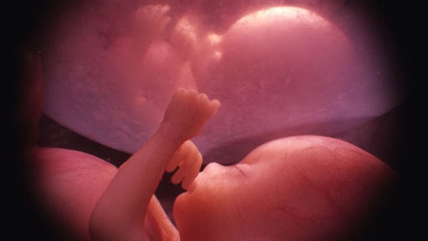 Twins-in-the-Womb-3014.jpg